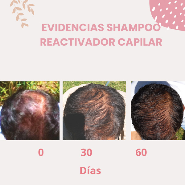 Shampoo Reactivador Capilar